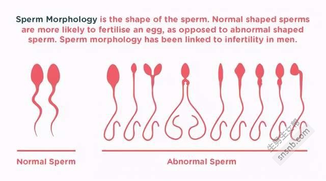 为什么这么多精子只有一个成功？答案是出乎意料的