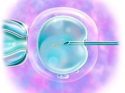 西安借卵试管助孕服务：泰国的IVF III治疗：短期、高效和安全。